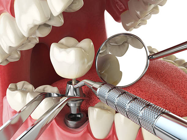 Best Same-Day Emergency Dentist in Chevy Chase Village, MD